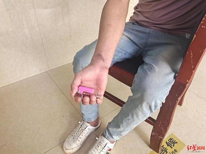 ↑逃跑过程中,王平手腕曾受伤