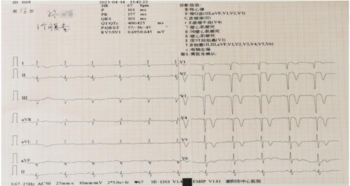 活心丸（浓缩丸）治疗病例之80—急性心肌梗死的男性患者