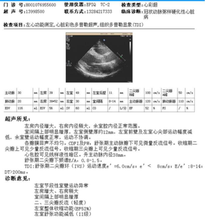 活心丸（浓缩丸）治疗病例之80—急性心肌梗死的男性患者