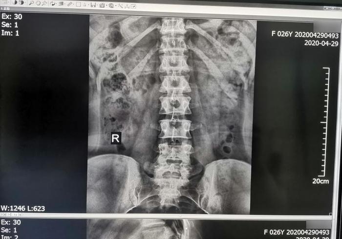 【康复之声】深层肌肉刺激仪在骨科疼痛中的临床应用