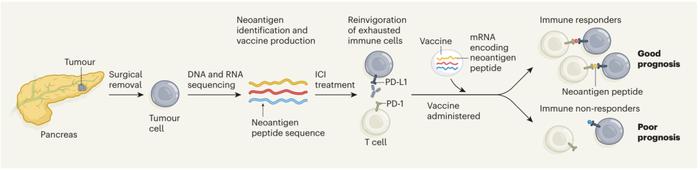 Nature重磅：个性化胰腺癌疫苗，在初期临床试验中取得惊人疗效