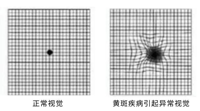 看了一天手机，你的眼睛还好吗？用五张眼部测试图测一下