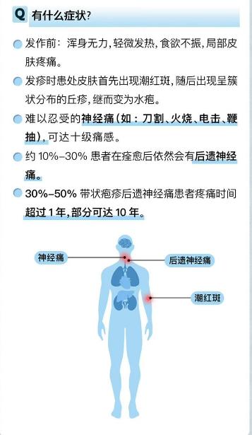 带状疱疹“蛇缠腰”，永州市可以打疫苗啦！