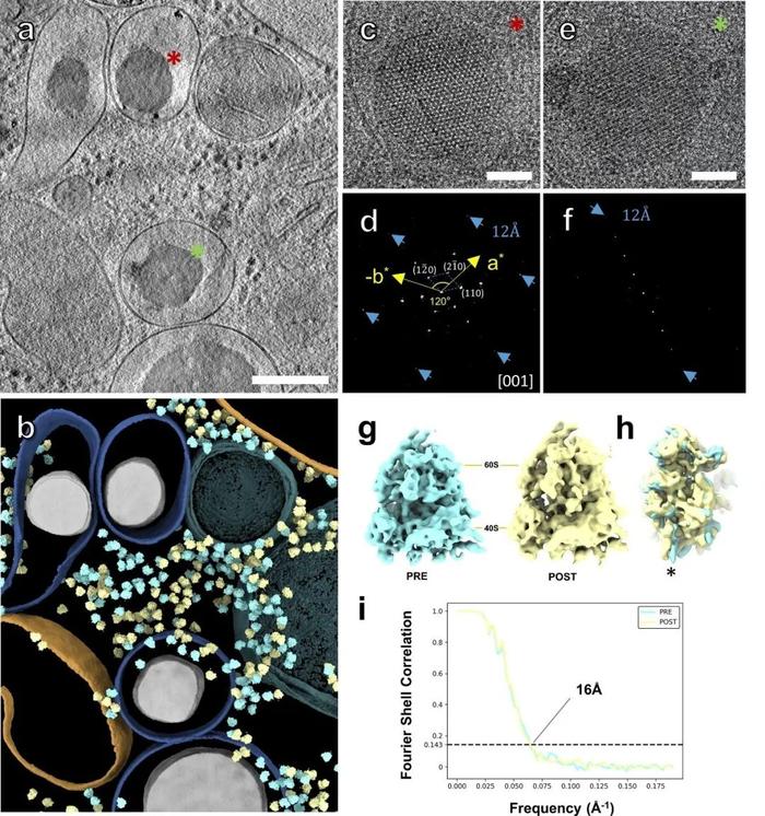 Journal of Structural Biology | 郭强课题组开发适用于组织样品原位结构研究的方法