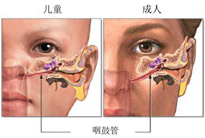 科普｜游泳会引起中耳炎吗？游泳后出现耳痛怎么办？