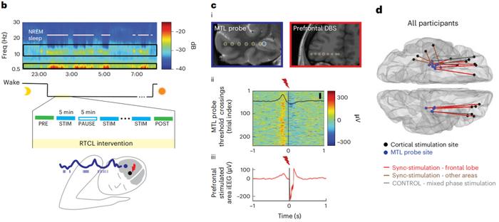 《自然·神经科学》：首个人体研究证实，睡眠期间同步刺激特定大脑区域，可以提高记忆力！