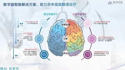 ASPECT 评分 AI 产品获批三类证,数坤打造更完善的卒中一站式解决方案