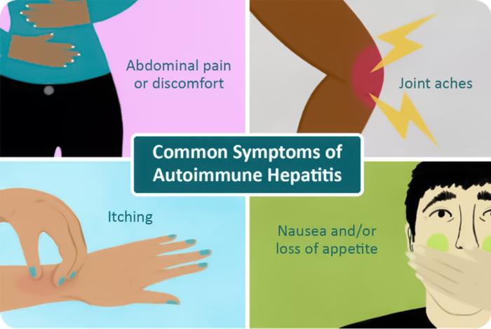 不容忽视的自身免疫性肝病