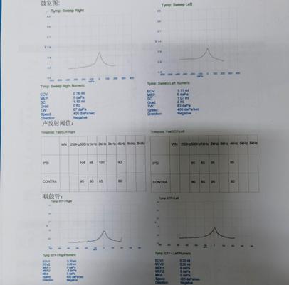 悦康通悦耳优秀病例7：突发性聋