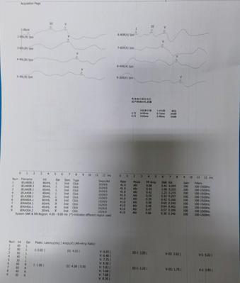 悦康通悦耳优秀病例7：突发性聋