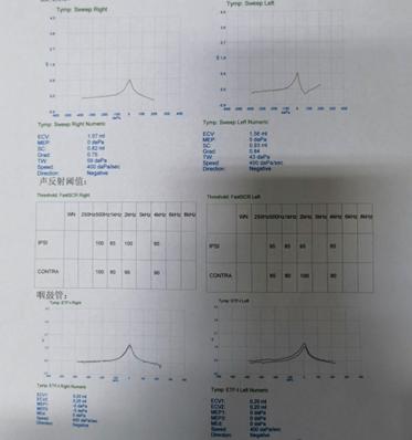 悦康通悦耳优秀病例7：突发性聋