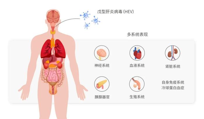 【世界肝炎日】——戊型肝炎知多少，预防“肝”货要记牢