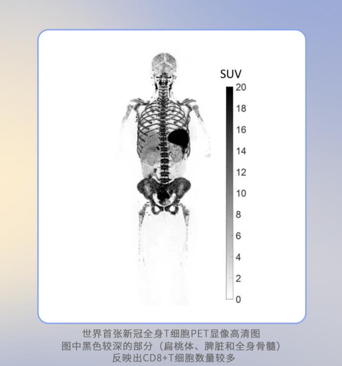 产医多方联合攻克重大疾病，探索者国际多中心科研合作推动解决肿瘤、免疫治疗、新药研发