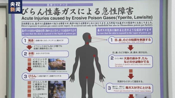 视频丨“毒气岛”记录战争罪行 警醒日本社会勿忘历史