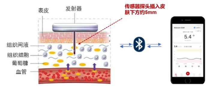 动态血糖仪到底准不准？看完这篇文章你就明白了