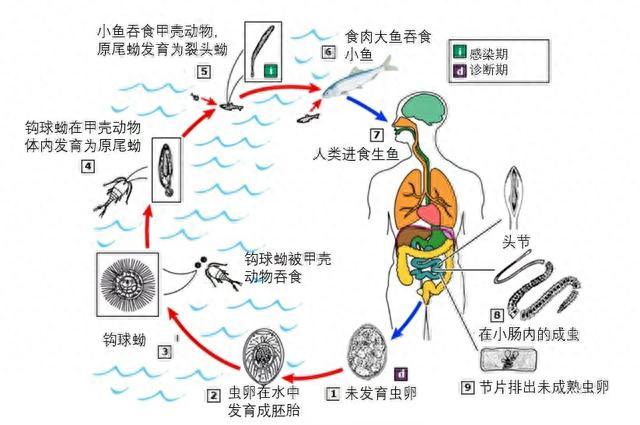 一口三文鱼刺身，医生从我肚子里拽出60cm活虫