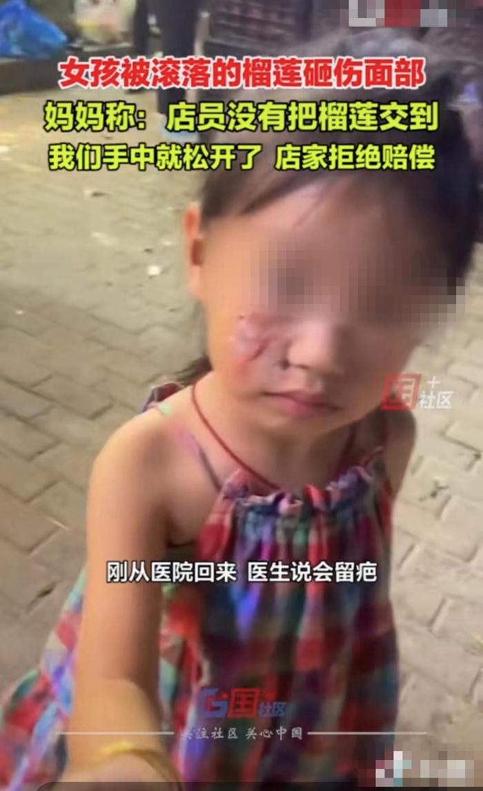 ↑女孩被榴莲砸伤面部