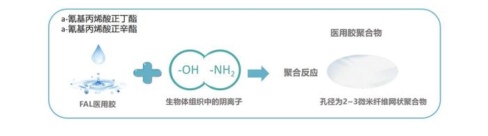 科普｜手术切口/伤口需要“闭合”，材料该怎么选？