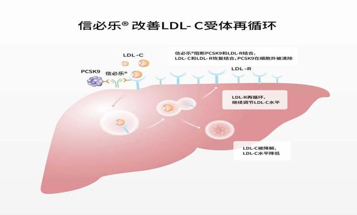 信达PCSK9降脂新药托莱西单抗注射液上市