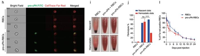 Cell Research｜西湖大学高晓飞团队开发红细胞载药平台用于治疗血栓性疾病