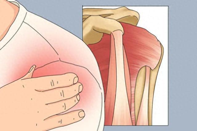 五十岁年龄的你，“五十肩”发作了吗？