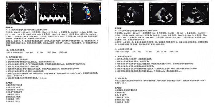 心血管内科完成院内首例经导管肺动脉瓣置换术