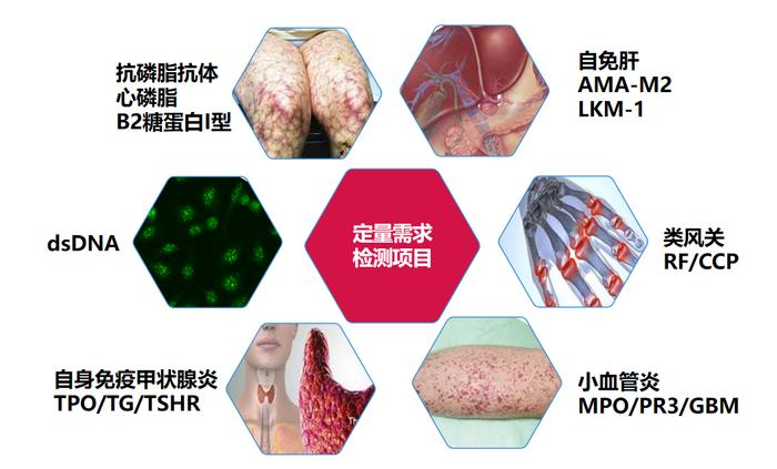 同是自身免疫系统异常导致的疾病，过敏和自免有什么不同？