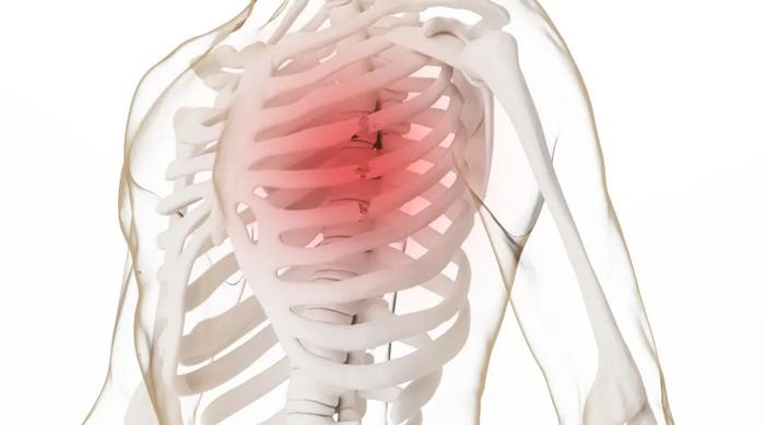 良医 | 肋骨骨折后只能靠躺？国家级专家共识来了