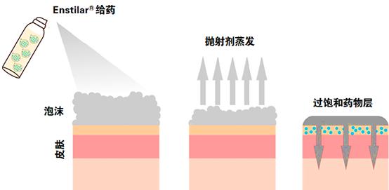 基于过饱和原理上市的卡泊三醇-丙酸倍他米松泡沫气雾剂