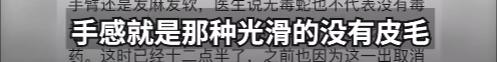 花2500元住上海知名酒店，女子熟睡时被蛇咬伤！