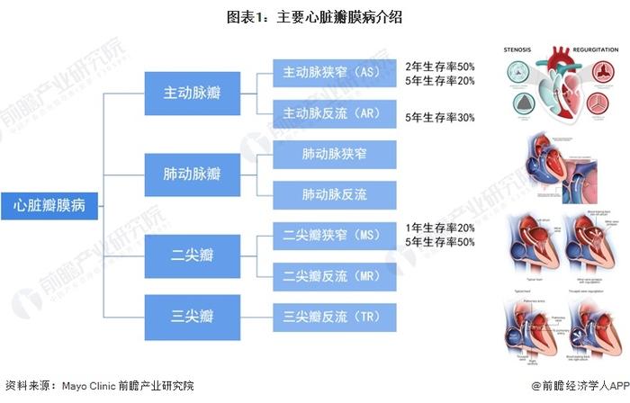 预见2024：《2024年中国心脏瓣膜行业全景图谱》(附市场现状、竞争格局和发展趋势等)