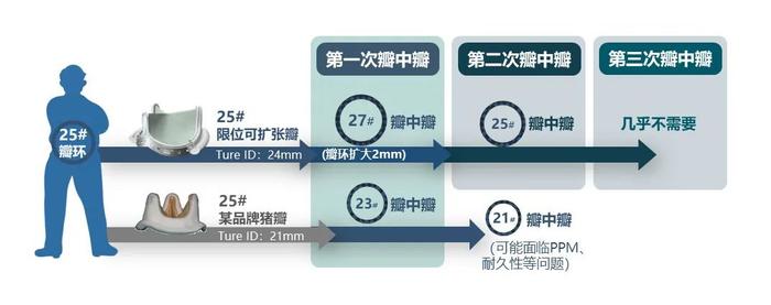 华东首例｜浙大一院马量、李伟栋主任团队成功应用佰迈思限位可扩张生物瓣完成华东地区首例植入