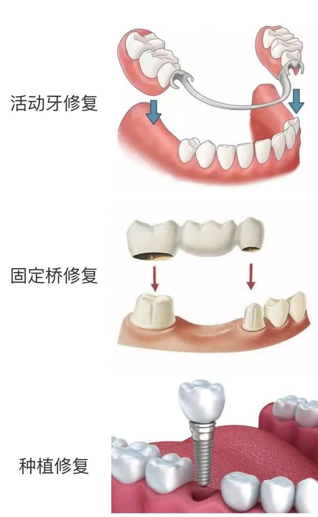 口腔溃疡牙龈肿痛，看牙该挂哪个科？最强挂号指南来了！