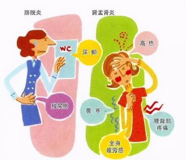 健康在线丨小心！“尿路感染”拉响女性健康警报