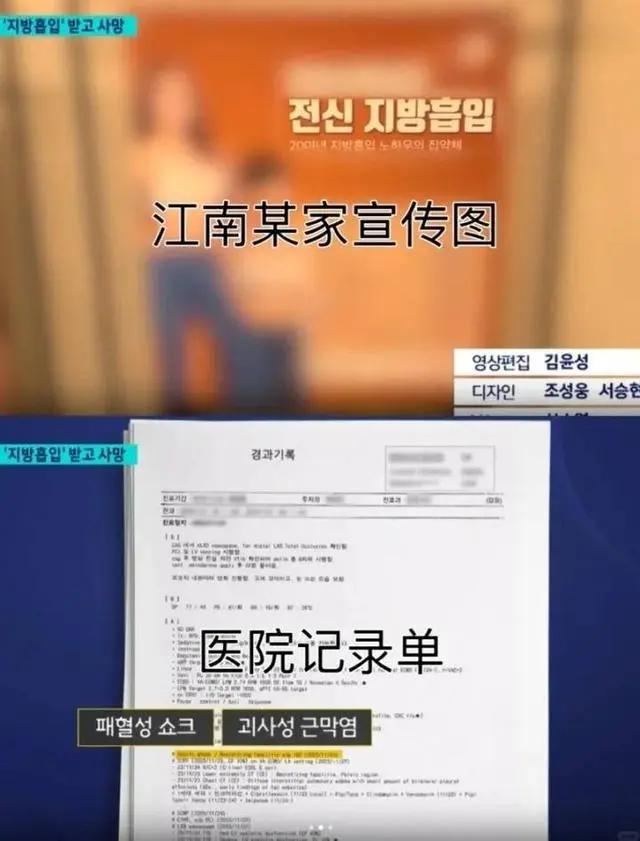 中国女孩赴韩整形后身亡！两周内做了三次抽脂手术！韩国警方计划尸检，当地华人：签证时间太紧迫……
