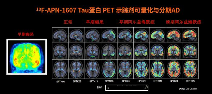 中国核药企业，向美国秘密递交IPO申请（附招股书下载）