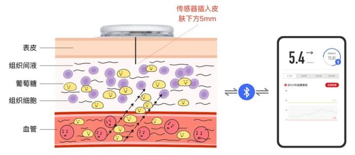 别再扎手指了！用它扫一下就能连续测血糖！