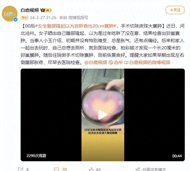 00后女生腹部隆起以为发胖查出20cm囊肿，手术切除皮球大囊肿