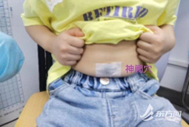 孩子营养不良、偏矮小？特色中医疗法来助力