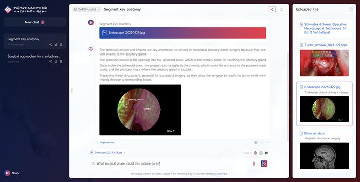多模态医疗大模型CARES Copilot 1.0发布 已面向香港神经外科医生开放使用