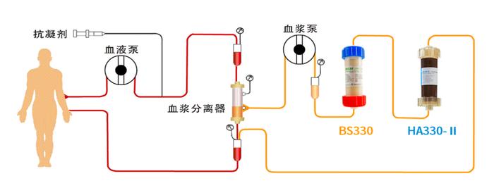 新文速递 | 代谢组学分析显示BS330吸附治疗对于ACLF患者具有更高的获益潜力