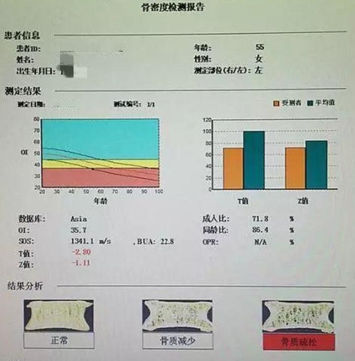 你知道超声骨密度检查和双能X线骨密度检查有什么不同吗