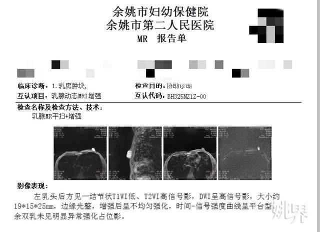 难以置信！浙江余姚58岁大叔竟患上乳腺癌！出现这些症状，一定要警惕