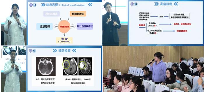 “慕课西部行·共享融合课堂”吉林大学与内蒙古民族大学第四期《儿科学》同步课堂顺利开展