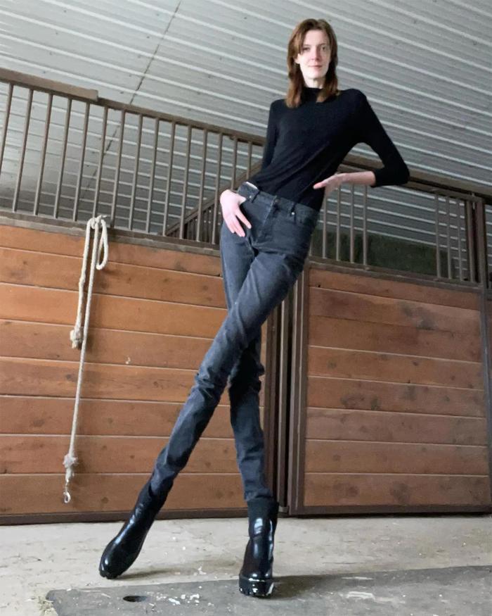 腿长135厘米！美国21岁女孩拥有世界“女性第一长腿”：光环背后是无数烦恼