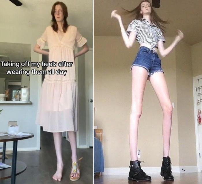 腿长135厘米！美国21岁女孩拥有世界“女性第一长腿”：光环背后是无数烦恼