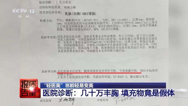 女子丰胸检出骆驼等动物源性成分