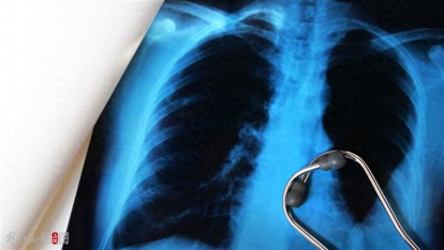 胸科专家“肺”常科普｜肺癌高危人群有哪些？哪种检查才能看清“西瓜”内部？