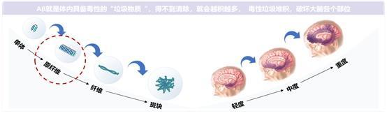 打开记忆之门的钥匙来了