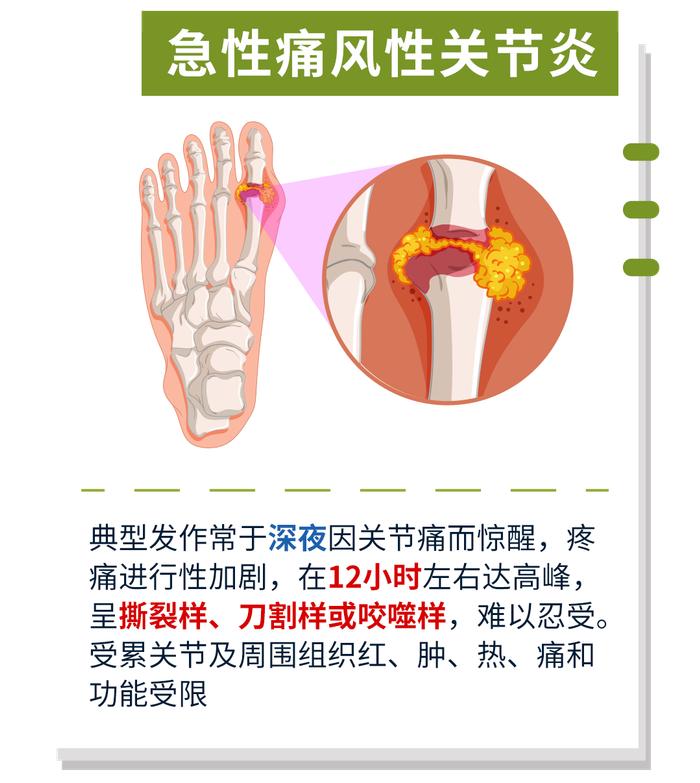 升尿酸比海鲜还猛！这3种水果制品别劝你别多吃！(广东男人必点)